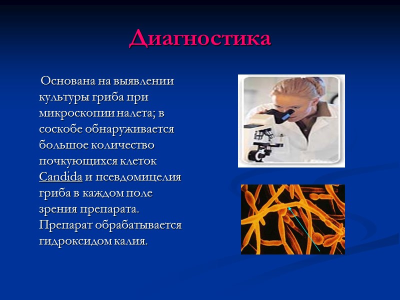 Диагностика      Основана на выявлении культуры гриба при микроскопии налета;
